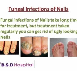 Slide12