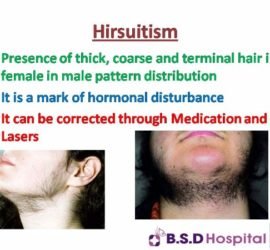 Slide15