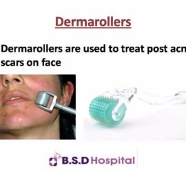 Slide26